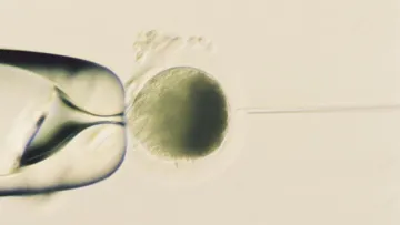 Ovule de jument immobilisé avec une pipette en vue de l’injection d’un spermatozoïde.