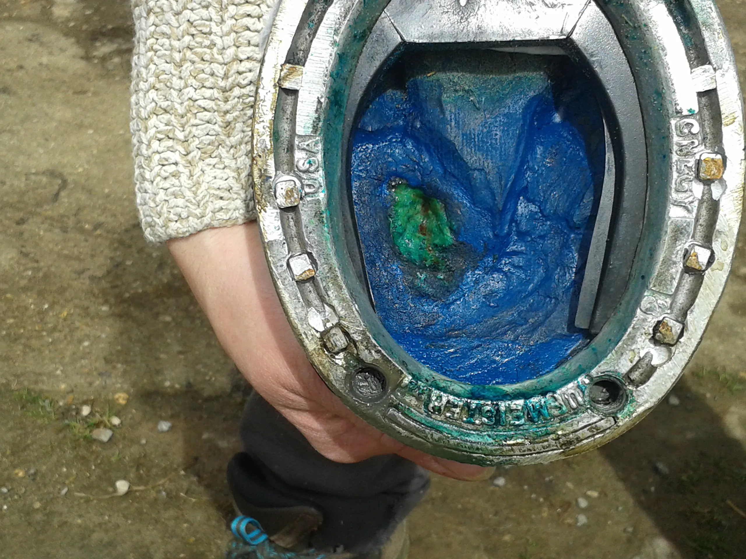 Le pied de Kenzack avec ce que les professionnels croyaient être un abcès